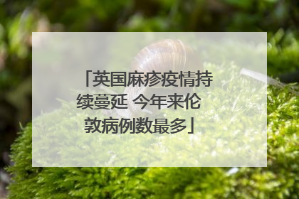 英国麻疹疫情持续蔓延 今年来伦敦病例数最多